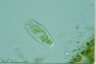 Condylostoma