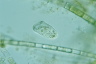 Condylostoma