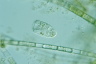 Condylostoma