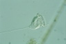 Vorticella