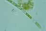 Vorticella