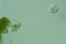 Vorticella