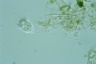 Vorticella