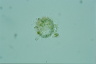 Choanocystis