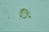 Choanocystis