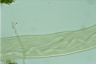 Spirostomum ambiguum