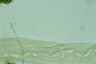 Spirostomum ambiguum