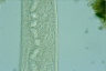 Spirostomum ambiguum