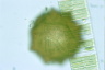 Arcella dentata