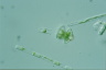 Dinobryon sertularia