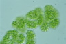 Botryococcus sudetica