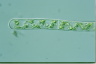 Spirogyra