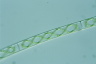 Spirogyra