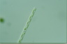 Spirogyra