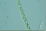 Spirogyra