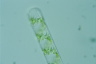 Spirogyra