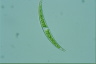 Closterium dianae