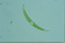 Closterium dianae