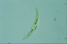 Closterium dianae