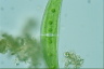 Closterium moniliferum