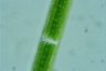 Closterium acerosum