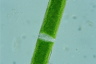 Closterium acerosum