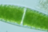 Closterium lunula