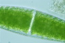 Closterium lunula