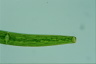 Closterium baillyanum