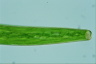 Closterium baillyanum