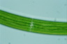 Closterium baillyanum