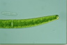 Closterium baillyanum