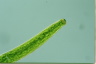 Closterium baillyanum