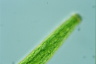 Closterium baillyanum