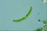 Closterium cynthia