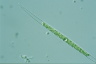 Closterium idiosporum