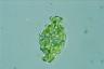 Euastrum ampullaceum