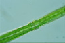 Pleurotaenium trabecula