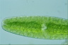 Netrium digitus