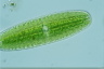 Netrium digitus