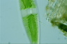 Netrium digitus