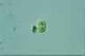 Cylindrocystis