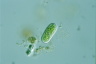 Cylindrocystis brebissonii