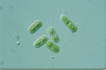 Cylindrocystis brebissonii