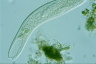 Spirostomum teres