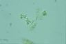 Microcystis