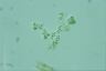 Microcystis