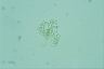 Microcystis