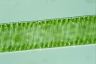 Spirogyra