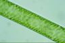 Spirogyra